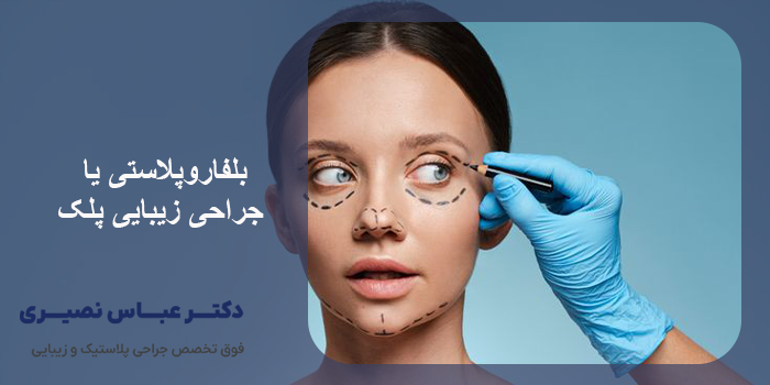 بلفاروپلاستی 