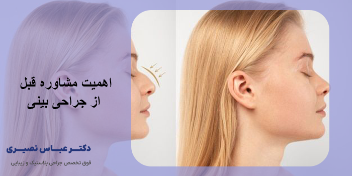 پرطرفدارترین نوع جراحی بینی کدام است؟