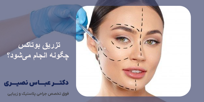 مراقبت‌ های قبل از تزریق بوتاکس