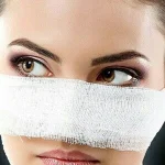 عوارض جراحی بینی