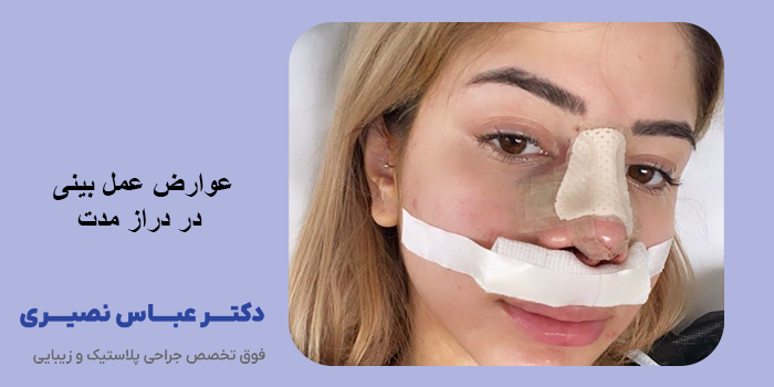 عوارض جراحی بینی