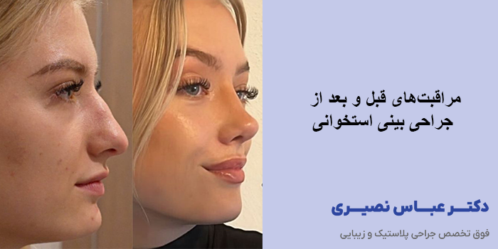 مراقبت‌های قبل و بعد از جراحی بینی استخوانی