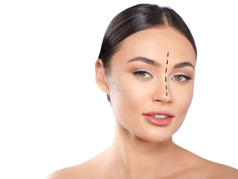 جراحی بینی گوشتی