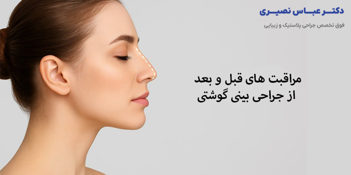 مراقبت های قبل و بعد از جراحی بینی گوشتی