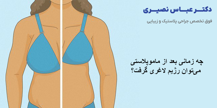 چه زمانی بعد از ماموپلاستی میتوان رژیم لاغری گرفت؟