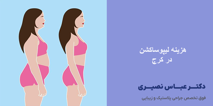 هزینه لیپوساکشن در سال 1404 در کرج