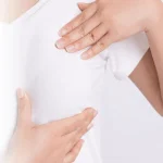 هزینه ماموپلاستی