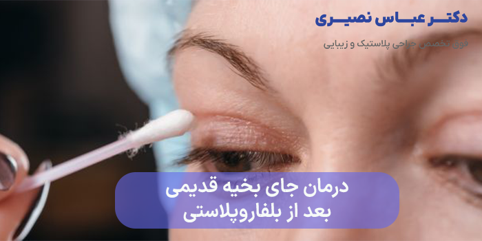 درمان جای بخیه قدیمی بعد از بلفاروپلاستی