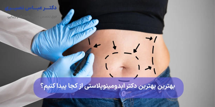 بهترین بهترین دکتر ابدومینوپلاستی از کجا پیدا کنیم؟