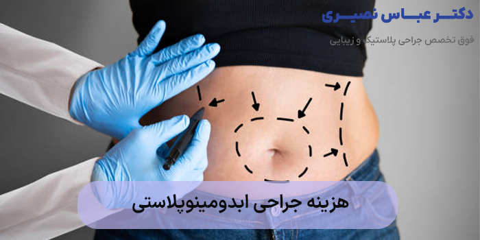 هزینه جراحی ابدومینوپلاستی