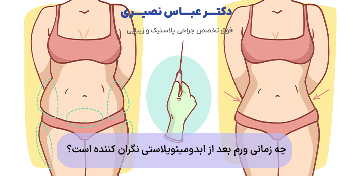 چه زمانی ورم بعد از ابدومینوپلاستی نگران کننده است؟