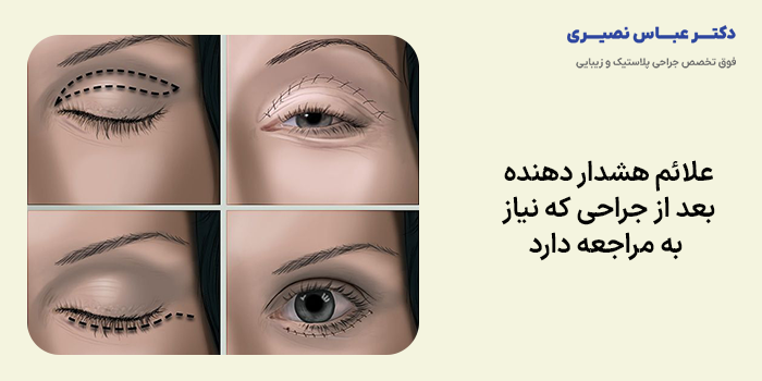 علائم هشدار دهنده بعد از جراحی که نیاز به مراجعه دارد
