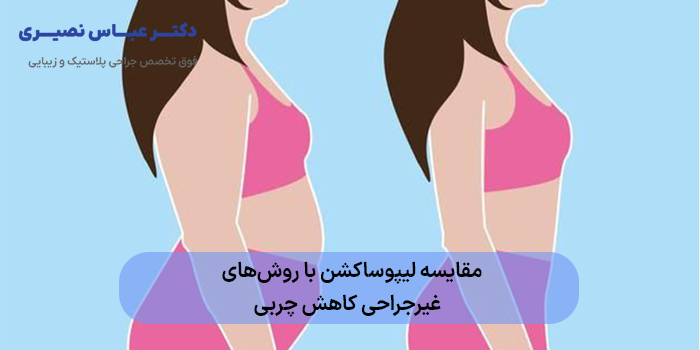 مقایسه لیپوساکشن با روشهای غیرجراحی کاهش چربی