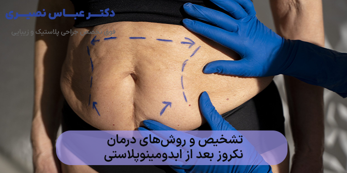 تشخیص و روشهای درمان نکروز بعد از ابدومینوپلاستی