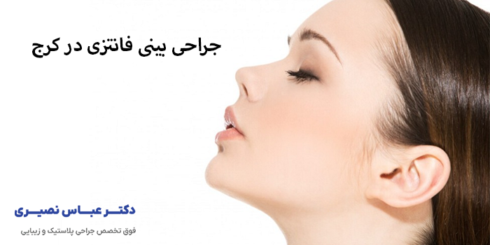 جراحی بینی فانتزی در کرج