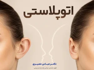 اتوپلاستی در کرج