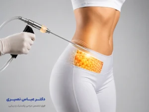 عمل لیپوماتیک