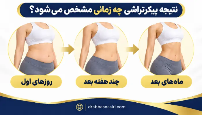 روند مشخص شدن نتیجه پیکرتراشی از روزهای اول تا ماه های بعد