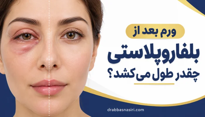ورم چشم بعد از بلفاروپلاستی